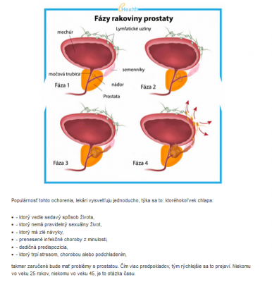 fazy prostaty.png